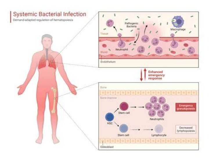Is bacteremia a systemic infection?